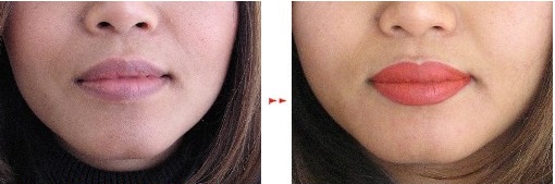 Volle lippen permanent makeup opvullen gehele lippen Full lips